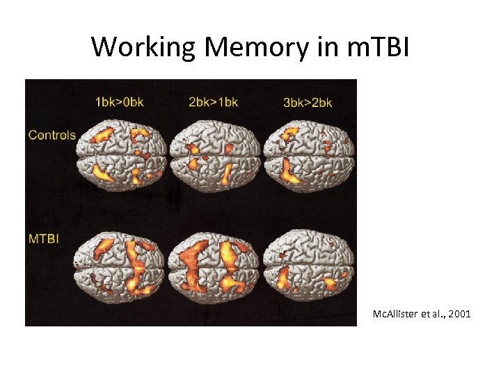 Working Memory in m. TBI Mc. Allister et al. , 2001 