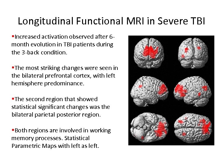 Longitudinal Functional MRI in Severe TBI §Increased activation observed after 6 month evolution in
