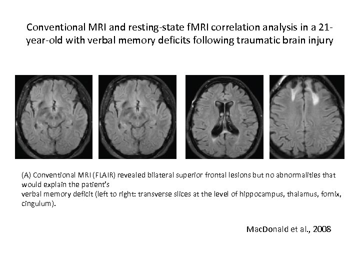 Conventional MRI and resting-state f. MRI correlation analysis in a 21 year-old with verbal