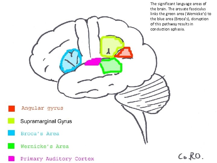 The significant language areas of the brain. The arcuate fasciculus links the green area