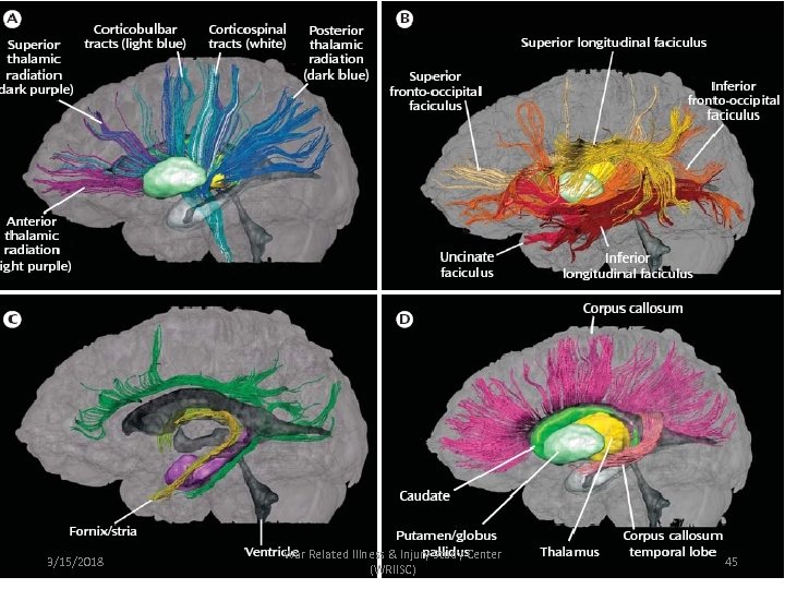 3/15/2018 War Related Illness & Injury Study Center (WRIISC) 45 