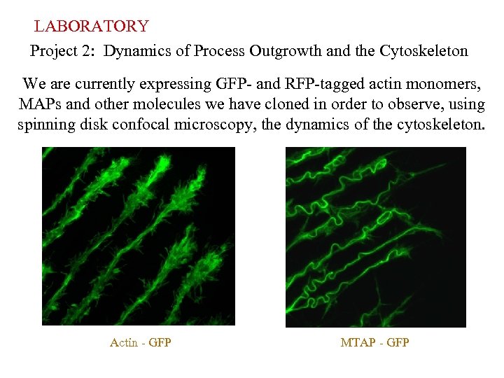 LABORATORY Project 2: Dynamics of Process Outgrowth and the Cytoskeleton We are currently expressing