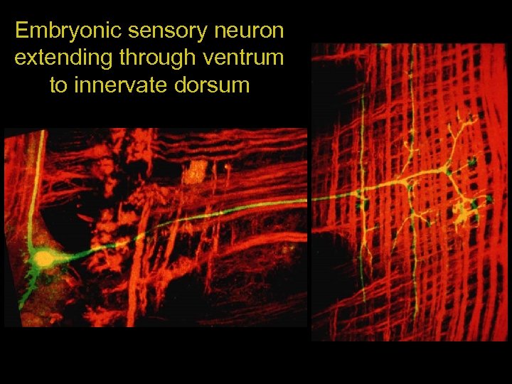 Embryonic sensory neuron extending through ventrum to innervate dorsum 