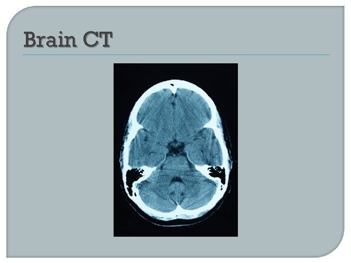 Brain CT 