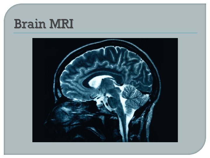 Brain MRI 