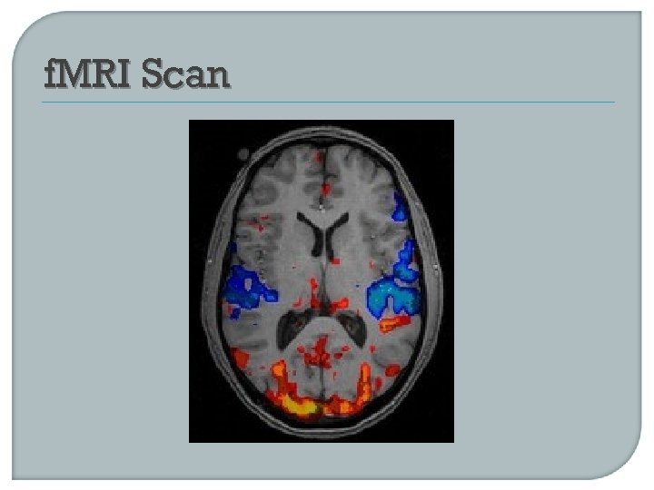 f. MRI Scan 