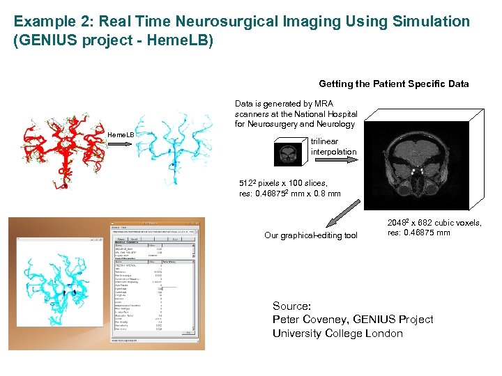 Example 2: Real Time Neurosurgical Imaging Using Simulation (GENIUS project - Heme. LB) Medical