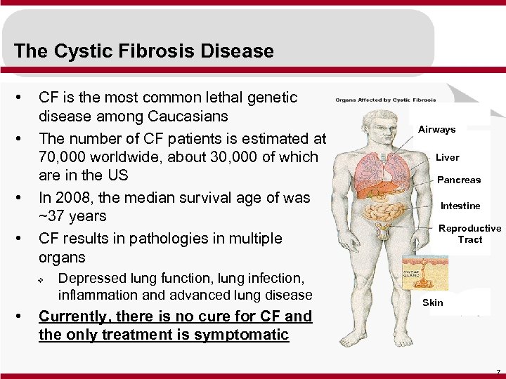 The Cystic Fibrosis Disease • • CF is the most common lethal genetic disease