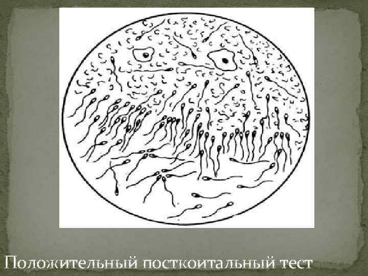 Положительный посткоитальный тест 