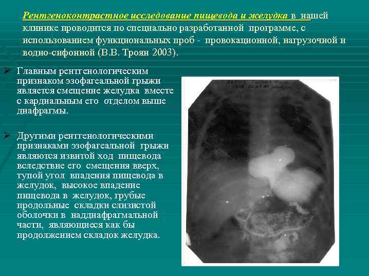 Рентгеноконтрастное исследование пищевода и желудка в нашей клинике проводится по специально разработанной программе, с