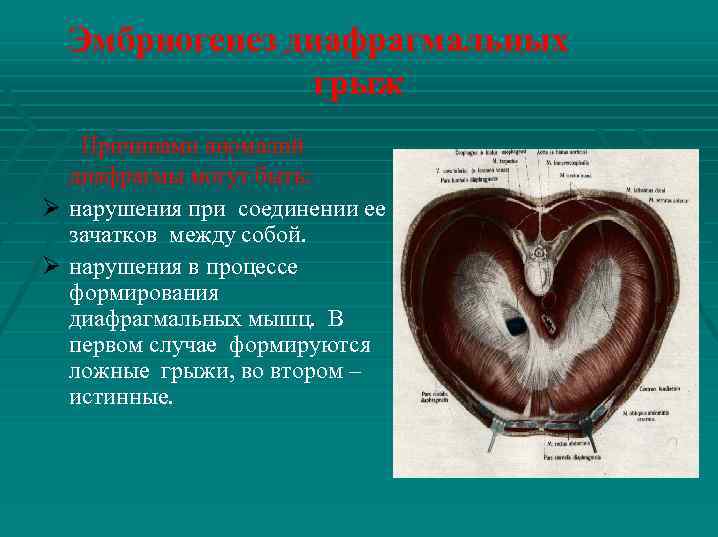 Эмбриогенез диафрагмальных грыж Причинами аномалий диафрагмы могут быть: Ø нарушения при соединении ее зачатков