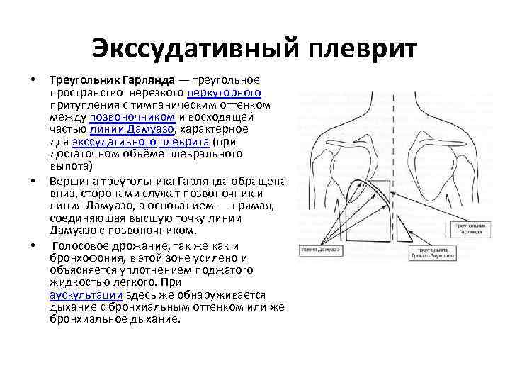 План обследования при экссудативном плеврите