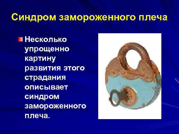 Синдром замороженного плеча Несколько упрощенно картину развития этого страдания описывает синдром замороженного плеча. 