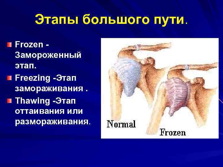 Этапы большого пути. Frozen Замороженный этап. Freezing -Этап замораживания. Thawing -Этап оттаивания или размораживания.