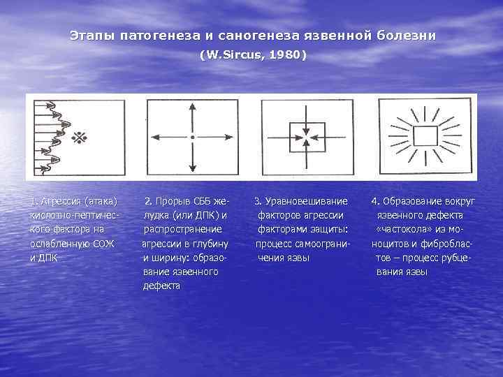 Этапы патогенеза и саногенеза язвенной болезни (W. Sircus, 1980) 1. Агрессия (атака) кислотно-пептического фактора