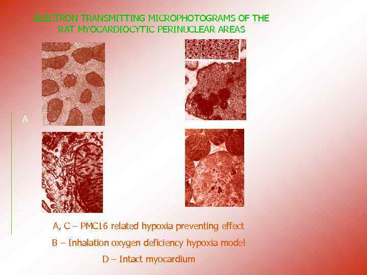 ELECTRON TRANSMITTING MICROPHOTOGRAMS OF THE RAT MYOCARDIOCYTIC PERINUCLEAR AREAS A C B D A,