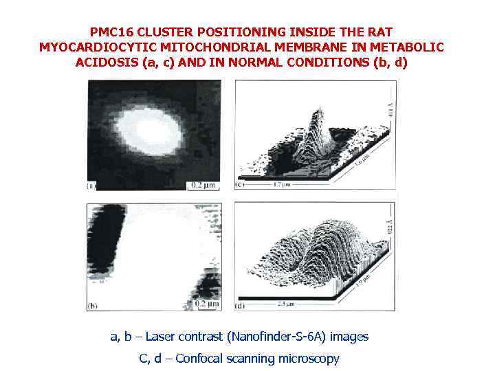 PMC 16 CLUSTER POSITIONING INSIDE THE RAT MYOCARDIOCYTIC MITOCHONDRIAL MEMBRANE IN METABOLIC ACIDOSIS (a,