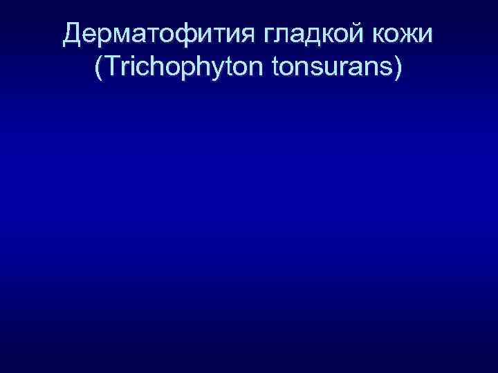 Дерматофития гладкой кожи (Trichophyton tonsurans) 