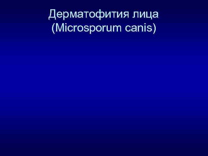 Дерматофития лица (Microsporum canis) 