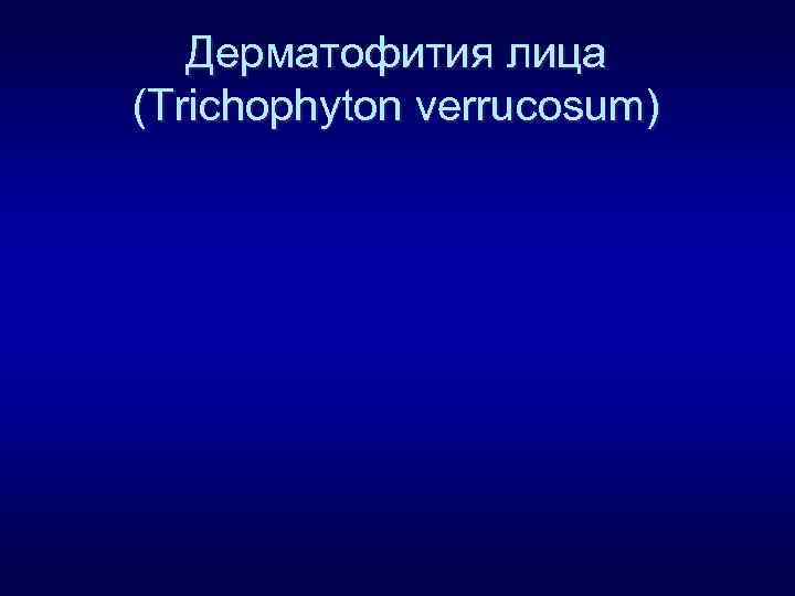 Дерматофития лица (Trichophyton verrucosum) 