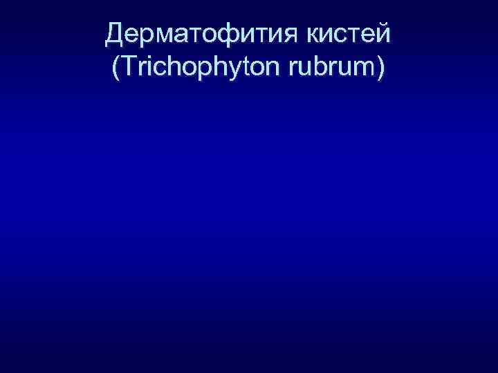 Дерматофития кистей (Trichophyton rubrum) 