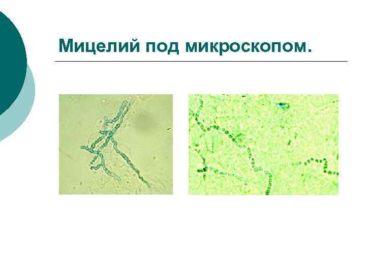 Мицелий под микроскопом. 