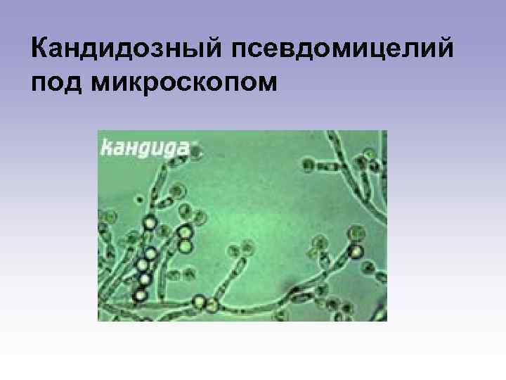 Кандидозный псевдомицелий под микроскопом 