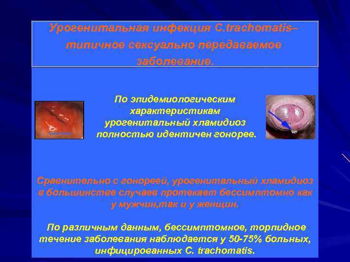 Урогенитальная инфекция С. trachomatis– типичное сексуально передаваемое заболевание. По эпидемиологическим характеристикам урогенитальный хламидиоз полностью