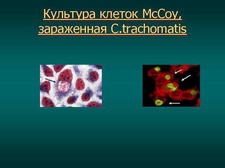 Культура клеток Mc. Coy, зараженная C. trachomatis 