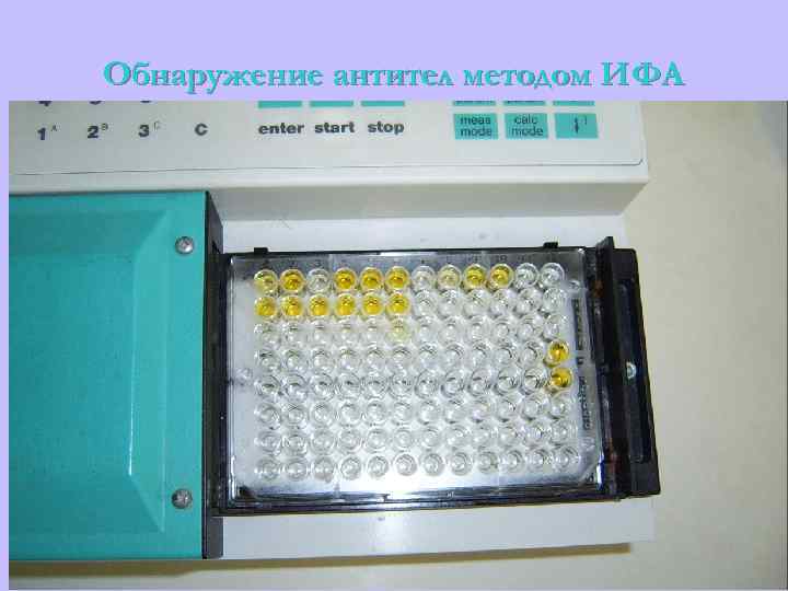 Обнаружение антител методом ИФА 