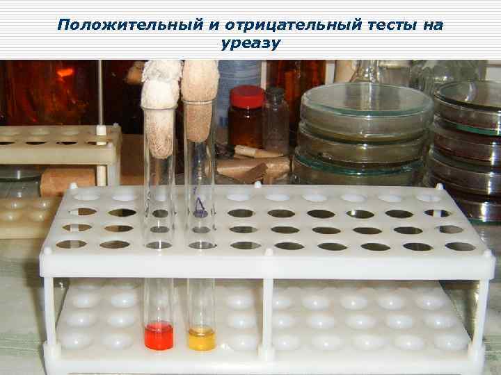 Положительный и отрицательный тесты на уреазу 