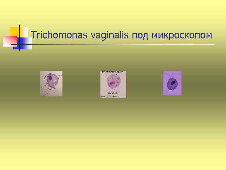 Trichomonas vaginalis под микроскопом 