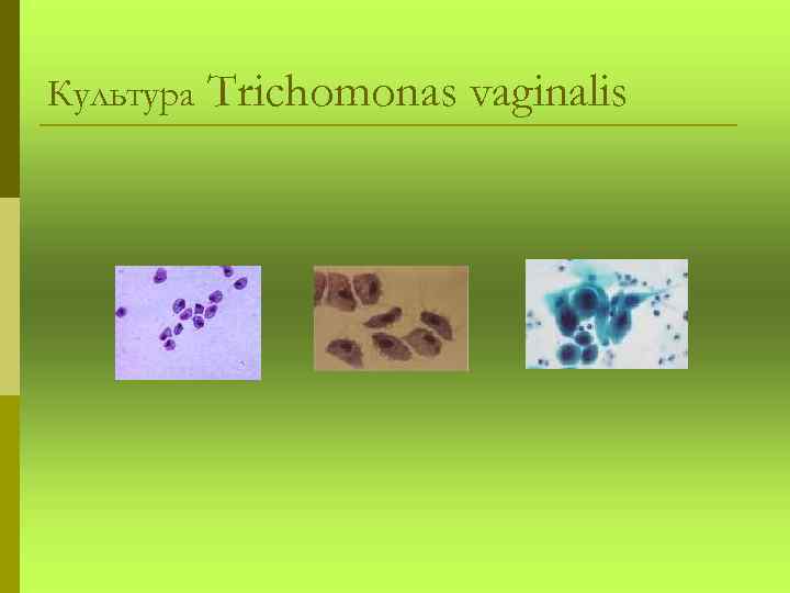 Культура Trichomonas vaginalis 