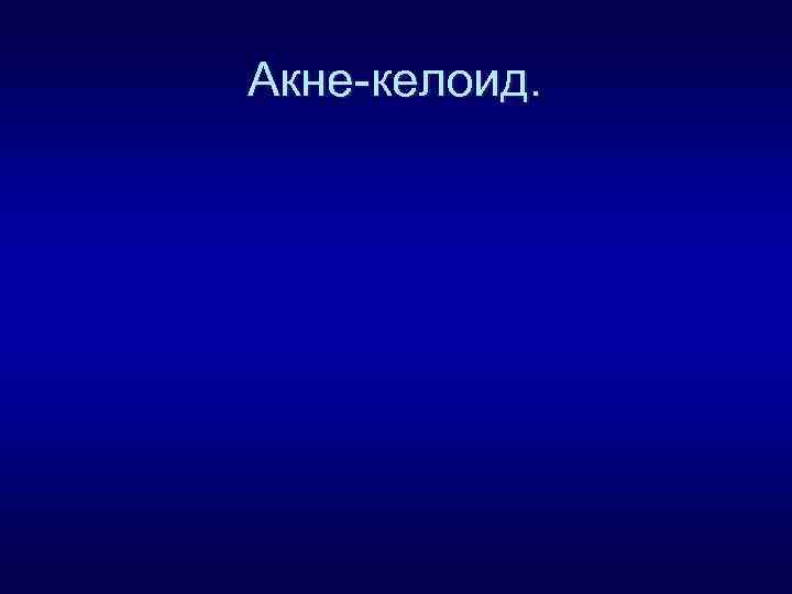 Акне-келоид. 