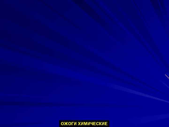 ОЖОГИ ХИМИЧЕСКИЕ 