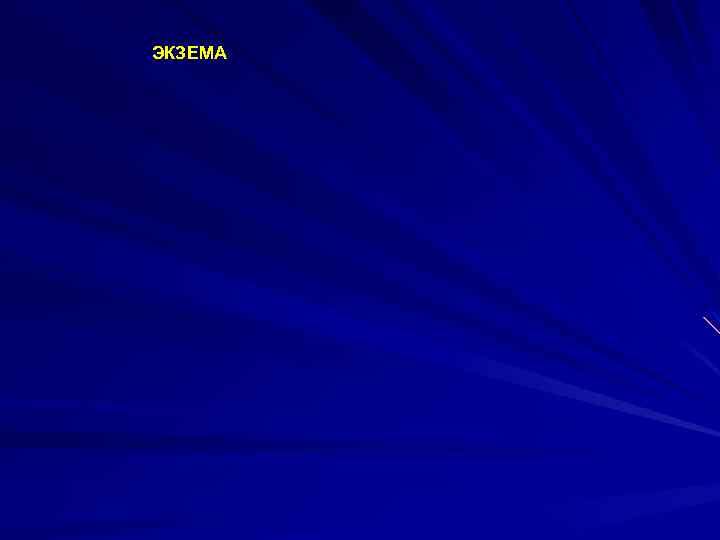 ЭКЗЕМА 
