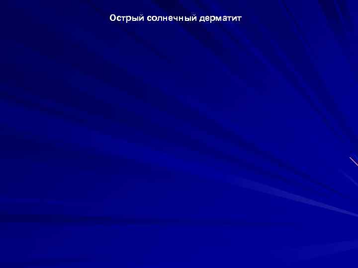 Острый солнечный дерматит 