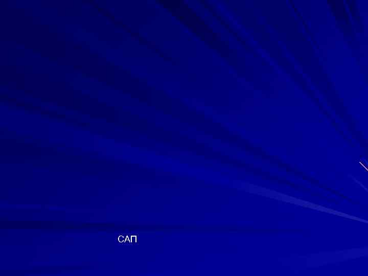САП 