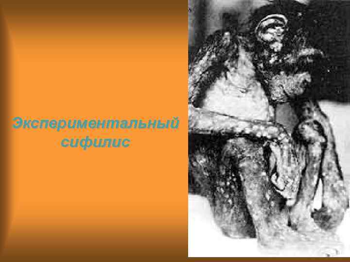 Экспериментальный сифилис 