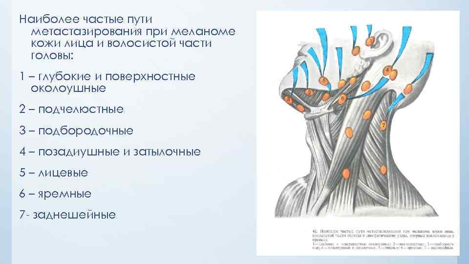 Наиболее частые пути метастазирования при меланоме кожи лица и волосистой части головы: 1 –