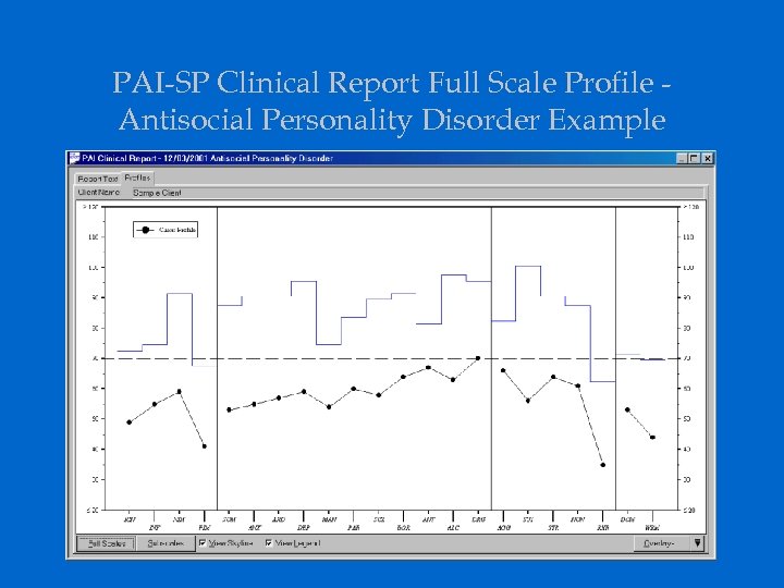 PAI-SP Clinical Report Full Scale Profile Antisocial Personality Disorder Example 