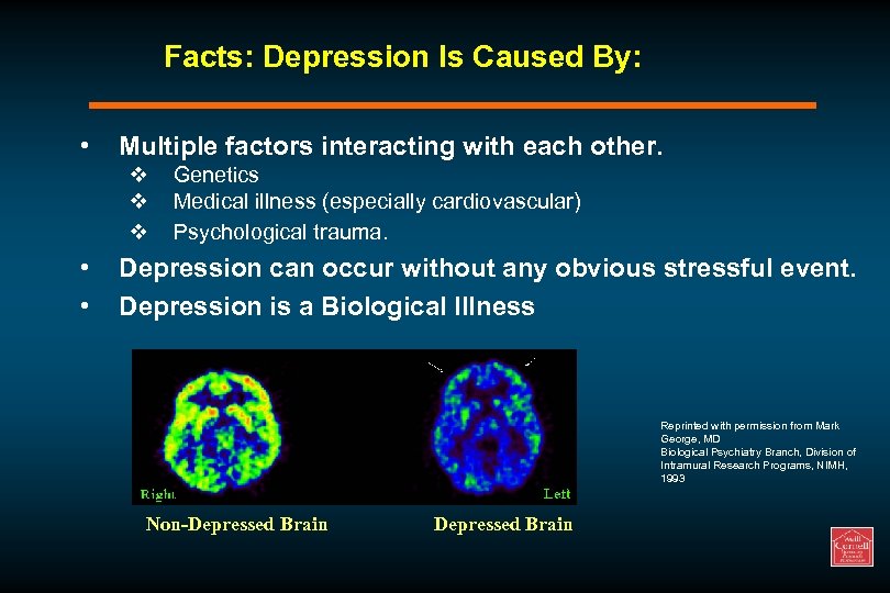 Facts: Depression Is Caused By: • Multiple factors interacting with each other. v v