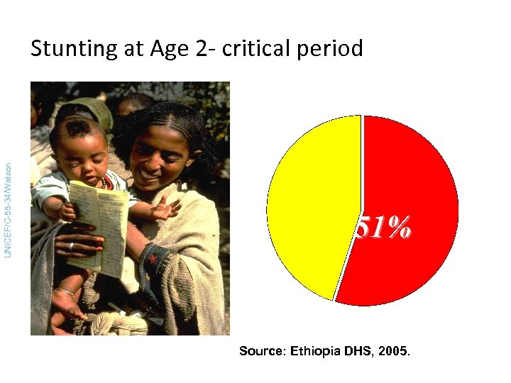 Stunting at Age 2 - critical period UNICEF/C-55 -34/Watson (EDHS - 2005) 51% Source: