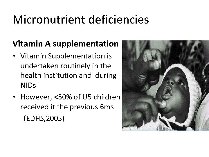 Micronutrient deficiencies Vitamin A supplementation • Vitamin Supplementation is undertaken routinely in the health