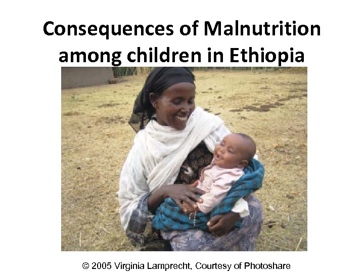 Consequences of Malnutrition among children in Ethiopia © 2005 Virginia Lamprecht, Courtesy of Photoshare