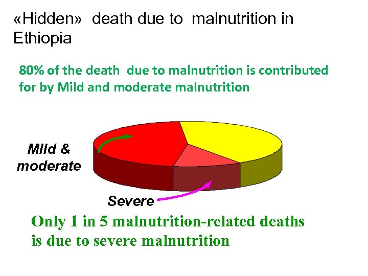  «Hidden» death due to malnutrition in Ethiopia 80% of the death due to