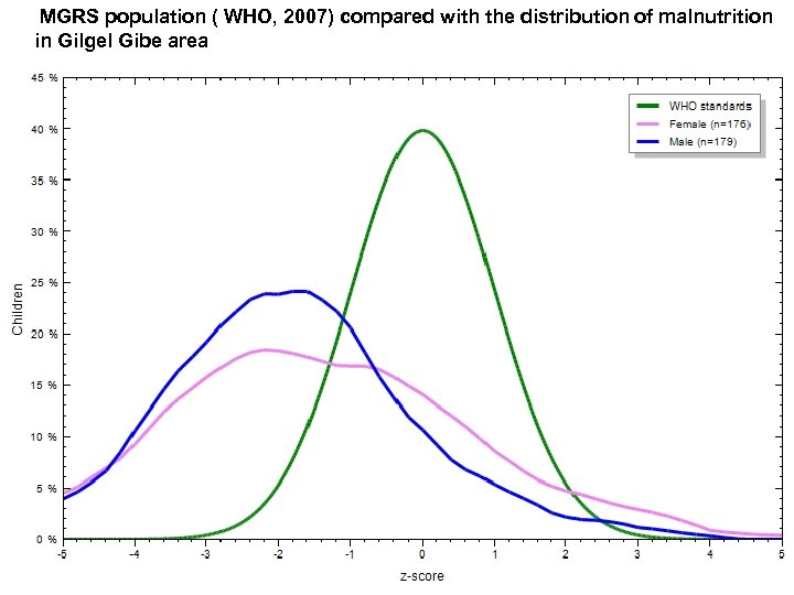 MGRS population ( WHO, 2007) compared with the distribution of malnutrition in Gilgel Gibe