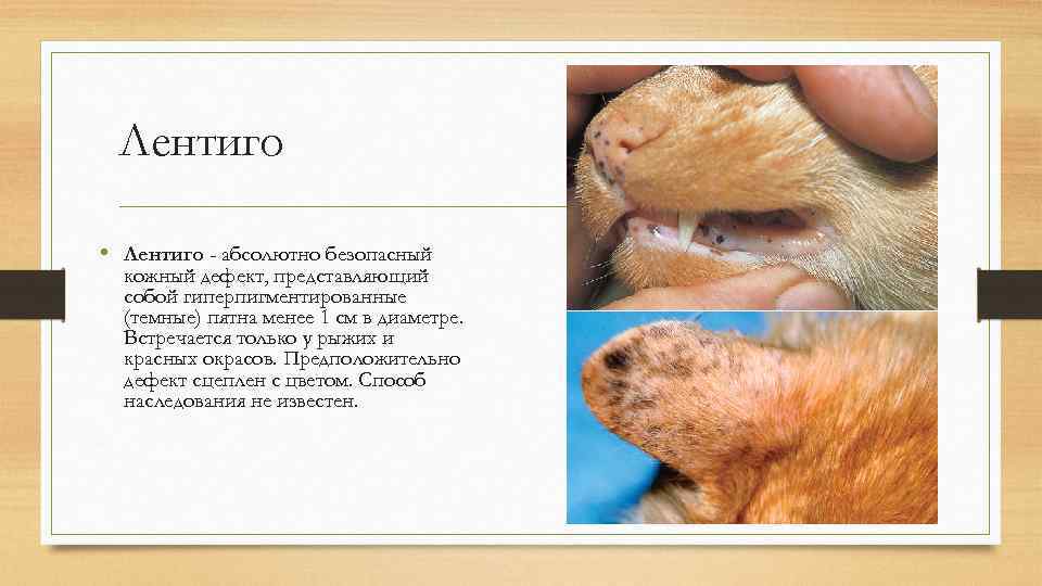 Лентиго • Лентиго - абсолютно безопасный кожный дефект, представляющий собой гиперпигментированные (темные) пятна менее