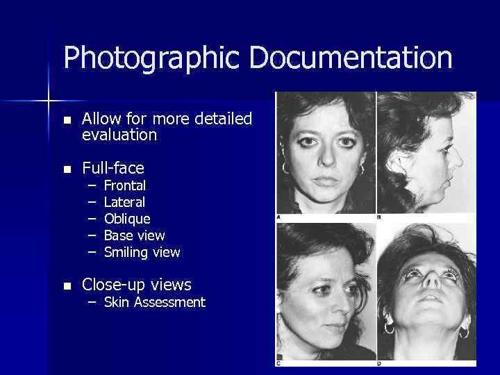 Photographic Documentation n Allow for more detailed evaluation n Full-face n – – –