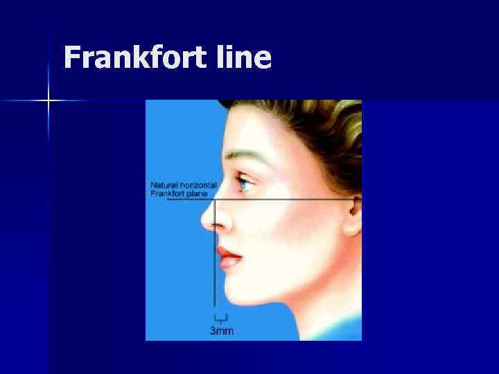 Frankfort line 